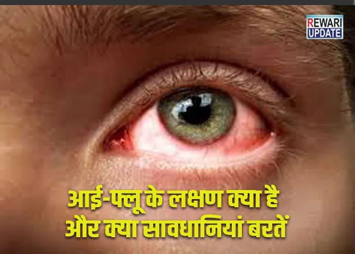 Eye-flu