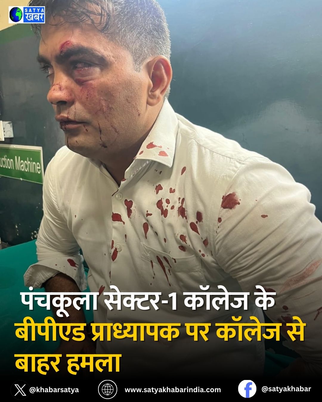 Haryana: पंचकूला सेक्टर-1 कॉलेज के बीपीएड प्राध्यापक पर कॉलेज से बाहर हमला