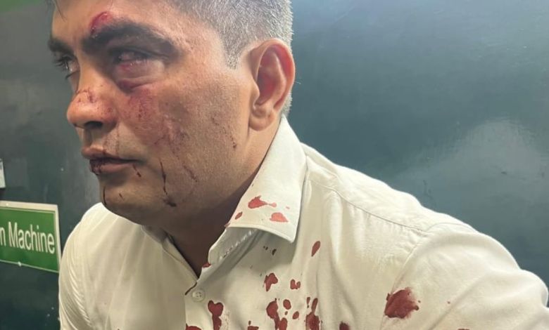 Haryana: पंचकूला सेक्टर-1 कॉलेज के बीपीएड प्राध्यापक पर कॉलेज से बाहर हमला